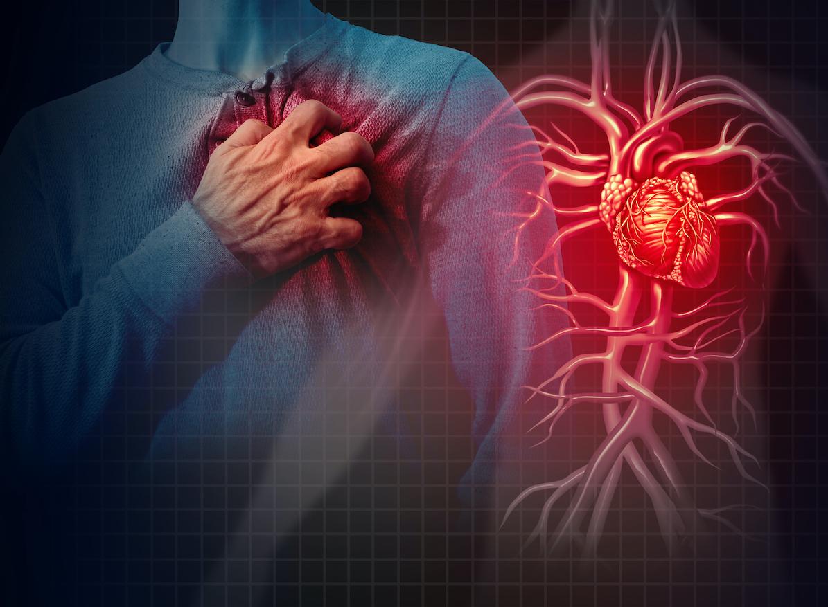 Une nouvelle étude du Lancet s'attaque à la mort subite d'origine cardiaque class=